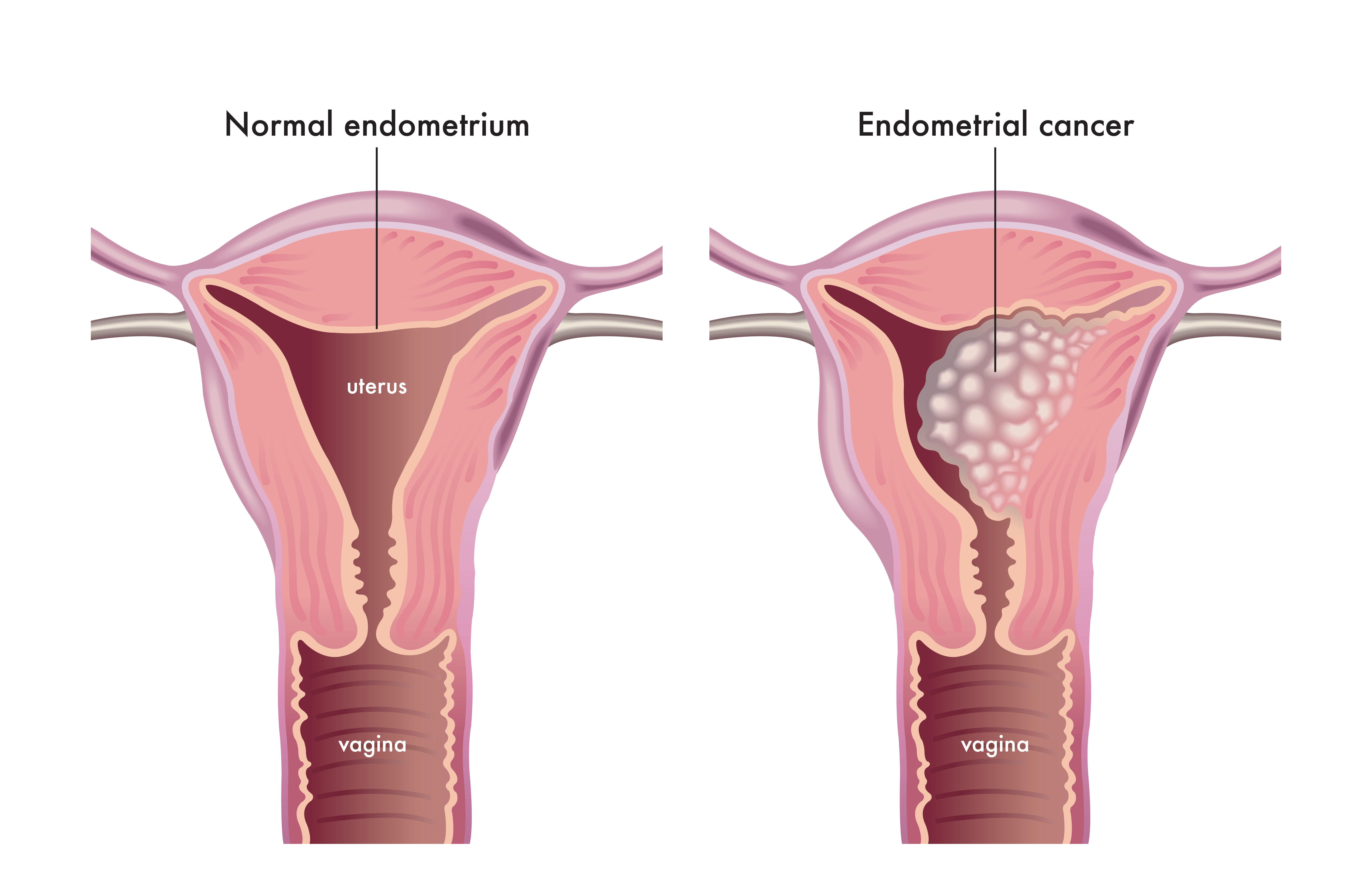 female-reproductive